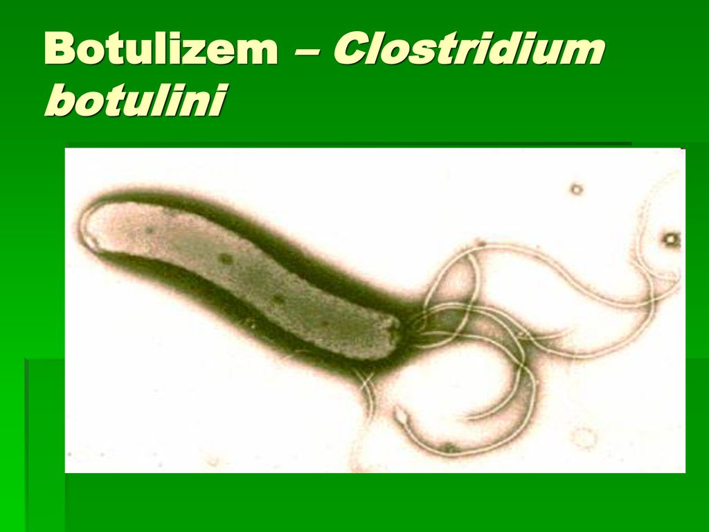 Botulizem – Clostridium botulini