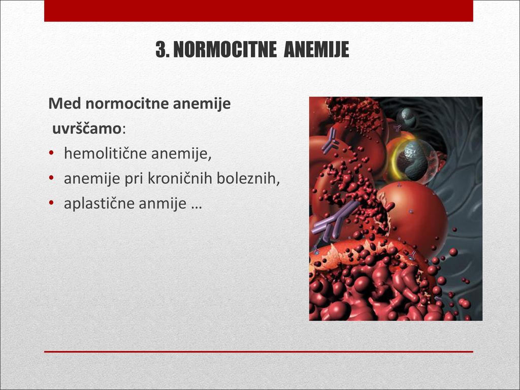 3. NORMOCITNE ANEMIJE Med normocitne anemije uvrščamo: